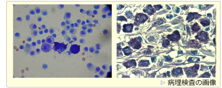 病理検査の画像